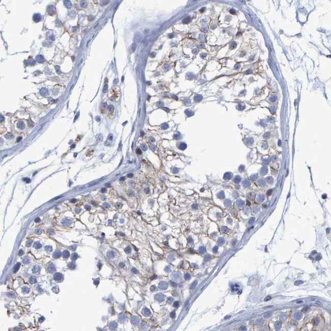 PROCA1 Antibody in Immunohistochemistry (Paraffin) (IHC (P))