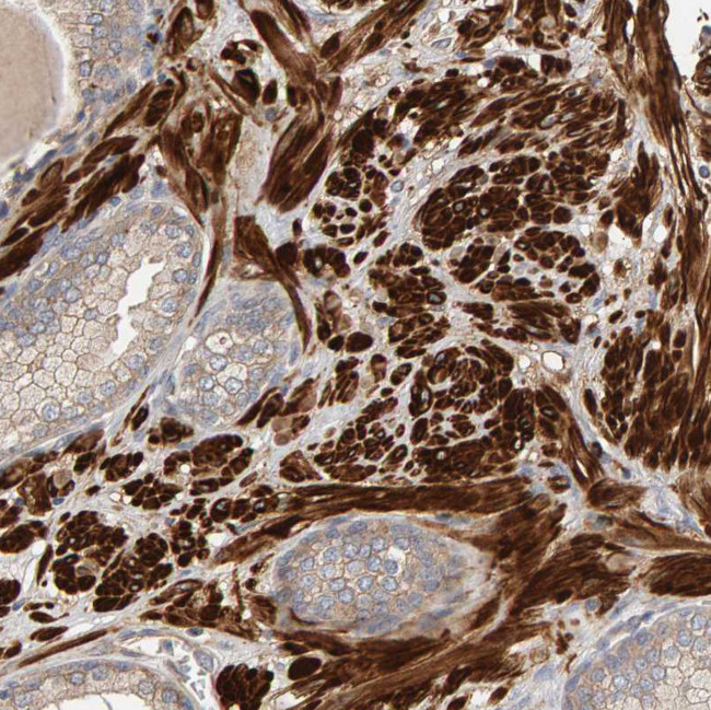 RNF19A Antibody in Immunohistochemistry (Paraffin) (IHC (P))