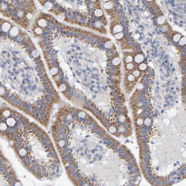 ZC3H3 Antibody in Immunohistochemistry (Paraffin) (IHC (P))
