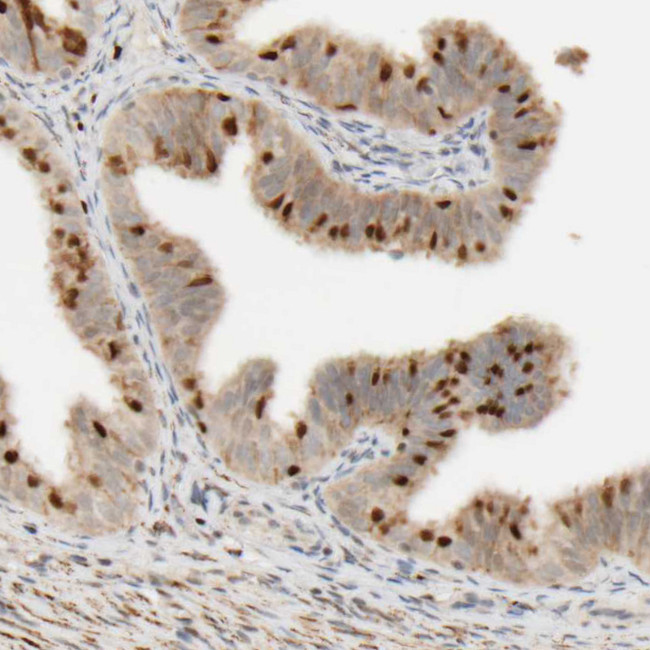 FMO1 Antibody in Immunohistochemistry (Paraffin) (IHC (P))