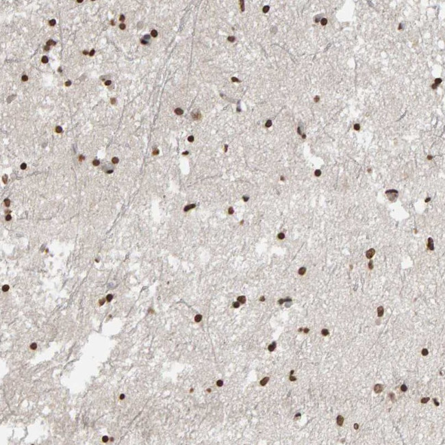 AFF4 Antibody in Immunohistochemistry (Paraffin) (IHC (P))