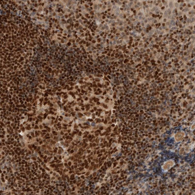 C8orf76 Antibody in Immunohistochemistry (Paraffin) (IHC (P))