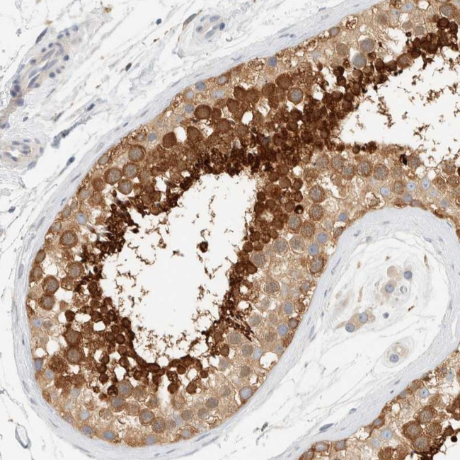 AARSD1 Antibody in Immunohistochemistry (Paraffin) (IHC (P))