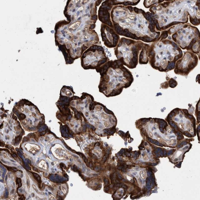 PROSC Antibody in Immunohistochemistry (Paraffin) (IHC (P))