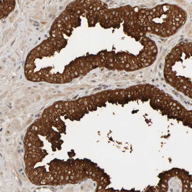 PPP1R16A Antibody in Immunohistochemistry (Paraffin) (IHC (P))