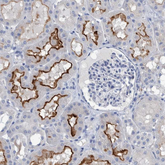 SLC34A3 Antibody in Immunohistochemistry (Paraffin) (IHC (P))