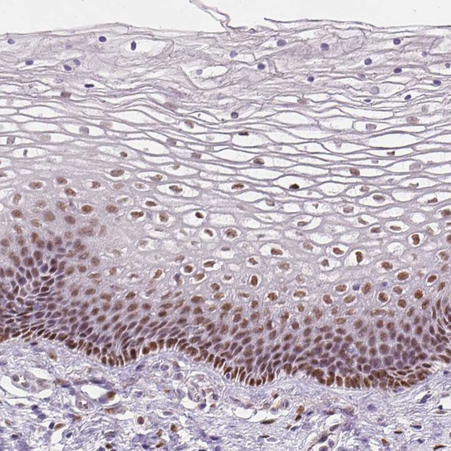 C1orf112 Antibody in Immunohistochemistry (Paraffin) (IHC (P))