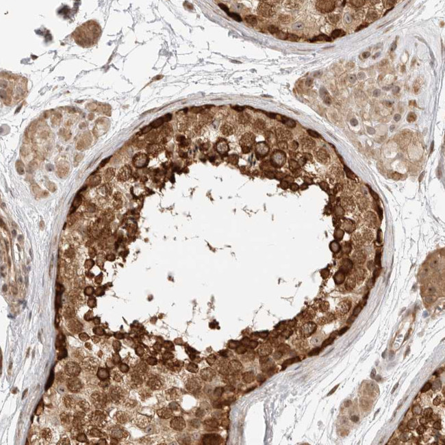 DSCC1 Antibody in Immunohistochemistry (Paraffin) (IHC (P))