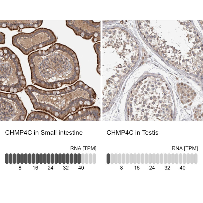 CHMP4C Antibody in Immunohistochemistry (IHC)