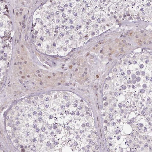ZNF583 Antibody in Immunohistochemistry (IHC)