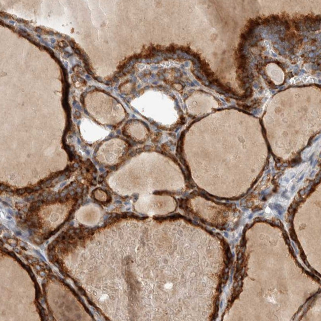 ADPRM Antibody in Immunohistochemistry (Paraffin) (IHC (P))