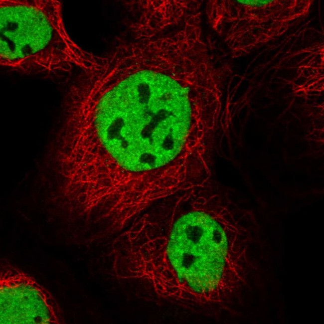 IBTK Antibody in Immunocytochemistry (ICC/IF)
