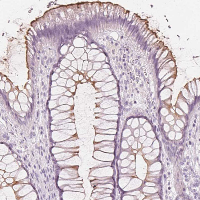 MUC12 Antibody in Immunohistochemistry (Paraffin) (IHC (P))