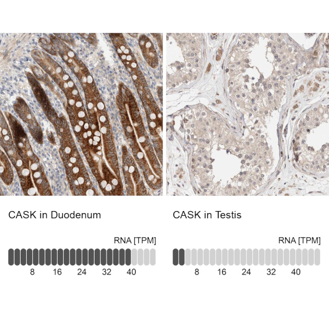 CASK Antibody in Immunohistochemistry (IHC)