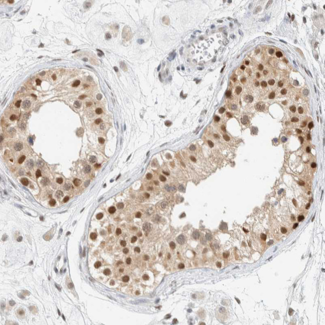 ZNF683 Antibody in Immunohistochemistry (Paraffin) (IHC (P))