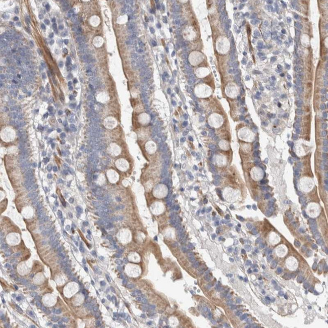 PSMG3 Antibody in Immunohistochemistry (Paraffin) (IHC (P))