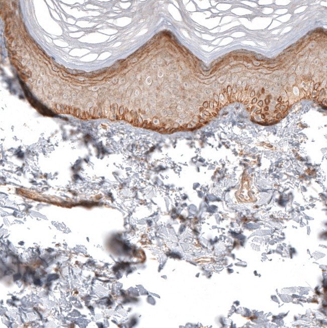 FAT1 Antibody in Immunohistochemistry (Paraffin) (IHC (P))