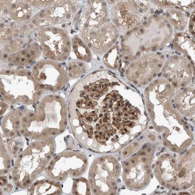 MYO1E Antibody in Immunohistochemistry (Paraffin) (IHC (P))