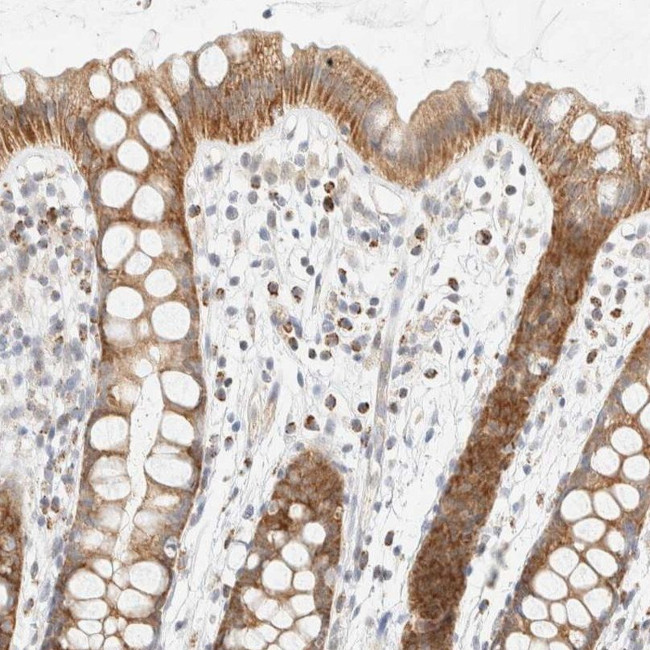 PPM1K Antibody in Immunohistochemistry (IHC)