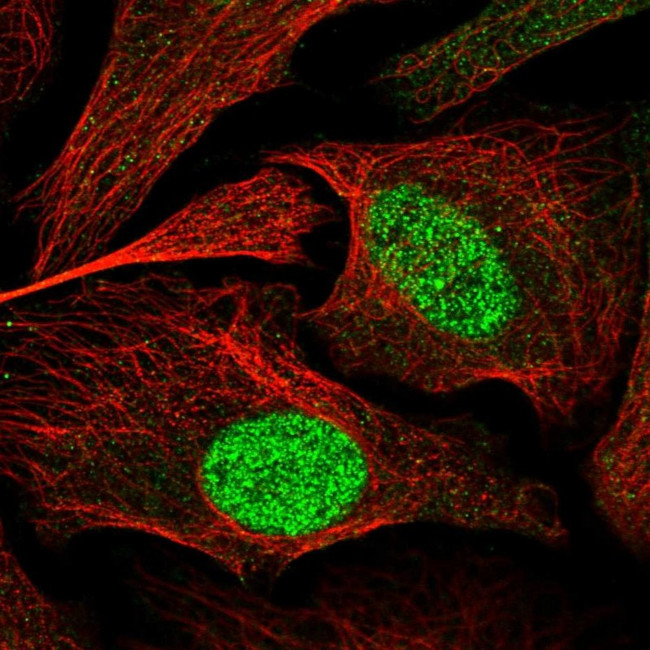 ZBTB34 Antibody in Immunocytochemistry (ICC/IF)