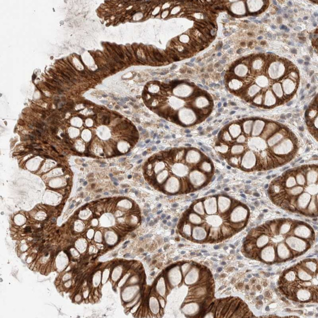 Adenylate Kinase 8 Antibody in Immunohistochemistry (Paraffin) (IHC (P))