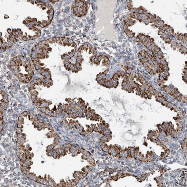 FAM78A Antibody in Immunohistochemistry (Paraffin) (IHC (P))