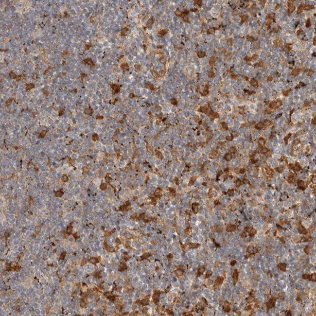 FAM167A Antibody in Immunohistochemistry (Paraffin) (IHC (P))