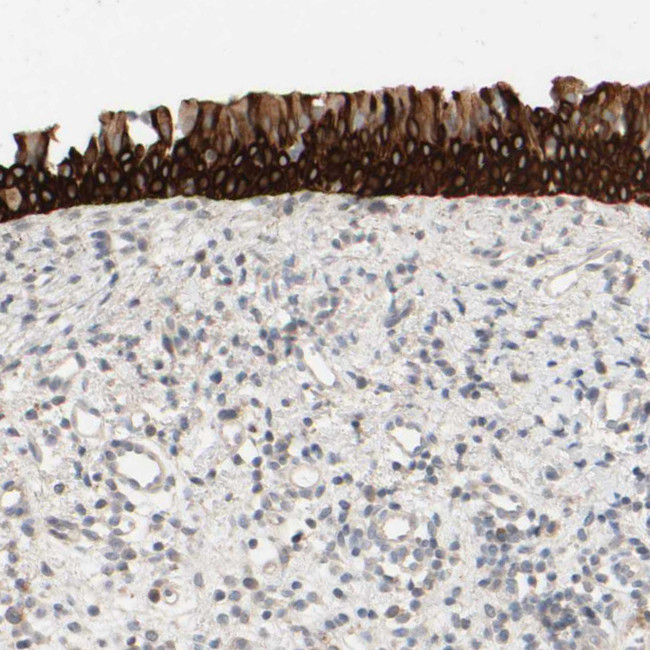 PRR11 Antibody in Immunohistochemistry (Paraffin) (IHC (P))