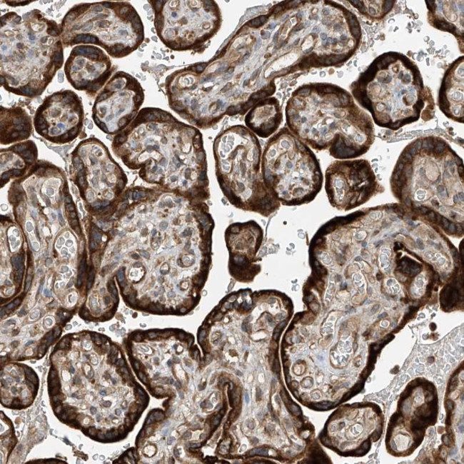 RPAIN Antibody in Immunohistochemistry (Paraffin) (IHC (P))