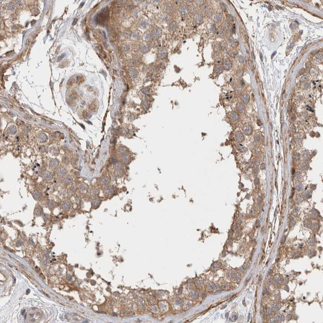 GSDMB Antibody in Immunohistochemistry (Paraffin) (IHC (P))