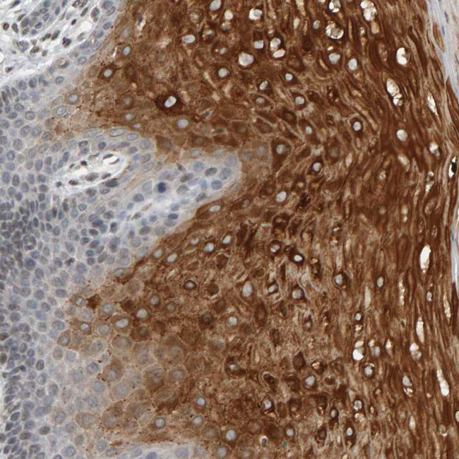 TRAM1 Antibody in Immunohistochemistry (Paraffin) (IHC (P))