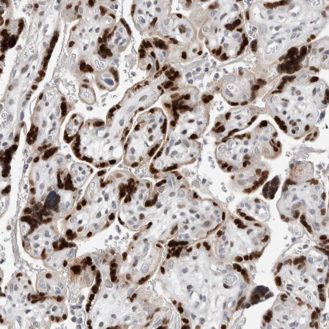ZNF703 Antibody in Immunohistochemistry (Paraffin) (IHC (P))
