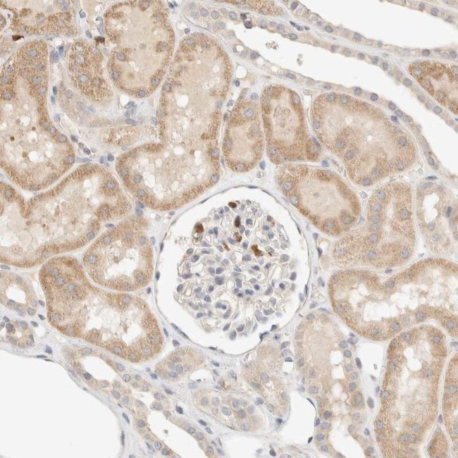 TTC3 Antibody in Immunohistochemistry (IHC)
