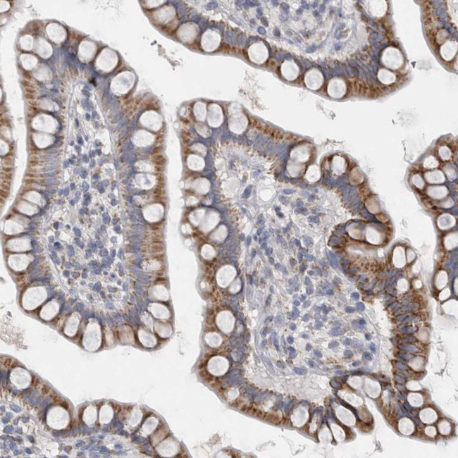 DHRS4 Antibody in Immunohistochemistry (Paraffin) (IHC (P))