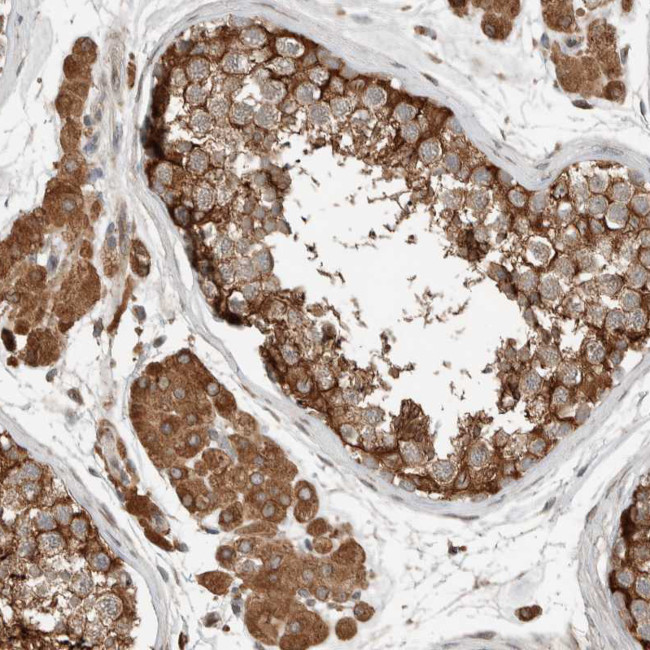 NBR1 Antibody in Immunohistochemistry (Paraffin) (IHC (P))