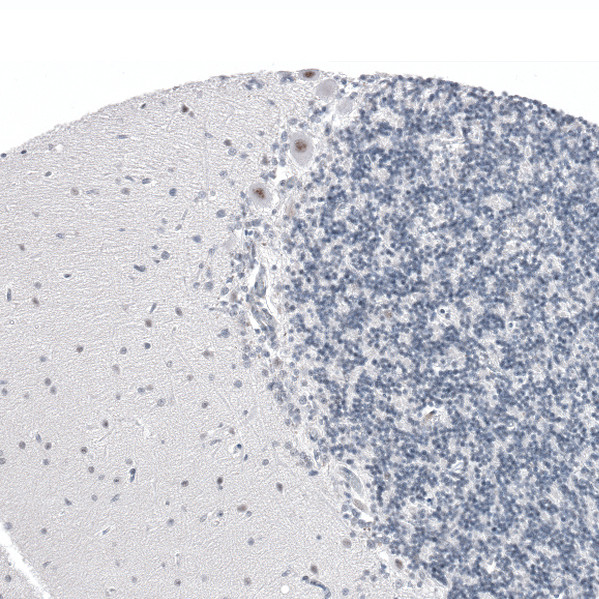 CAAP1 Antibody in Immunohistochemistry (Paraffin) (IHC (P))