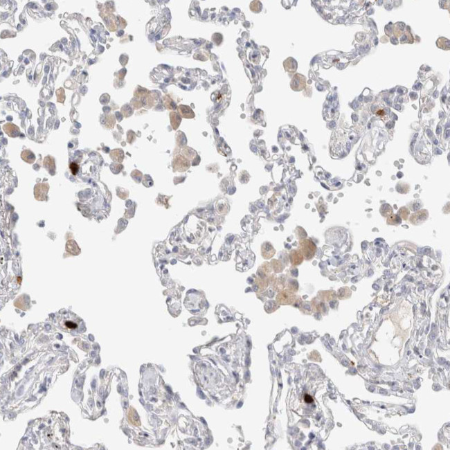 HPGDS Antibody in Immunohistochemistry (Paraffin) (IHC (P))