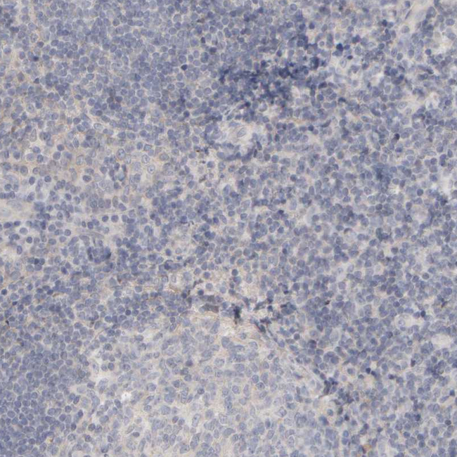 MSP Antibody in Immunohistochemistry (Paraffin) (IHC (P))