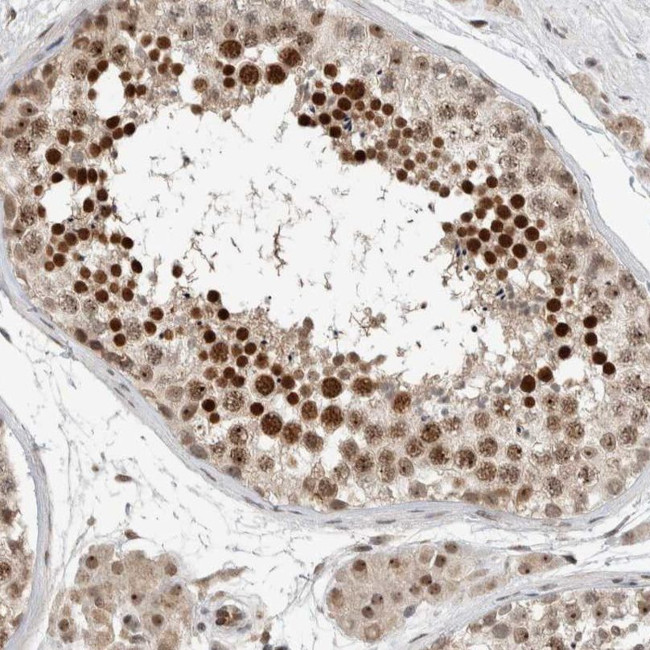 ZFP91 Antibody in Immunohistochemistry (IHC)