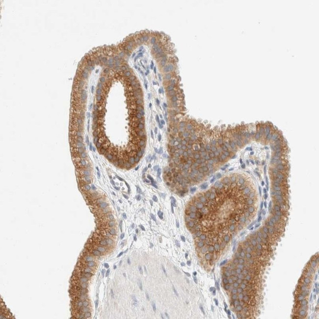 SUMF2 Antibody in Immunohistochemistry (IHC)