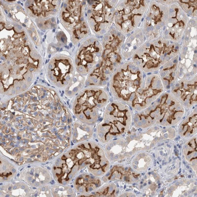 DCTN6 Antibody in Immunohistochemistry (Paraffin) (IHC (P))