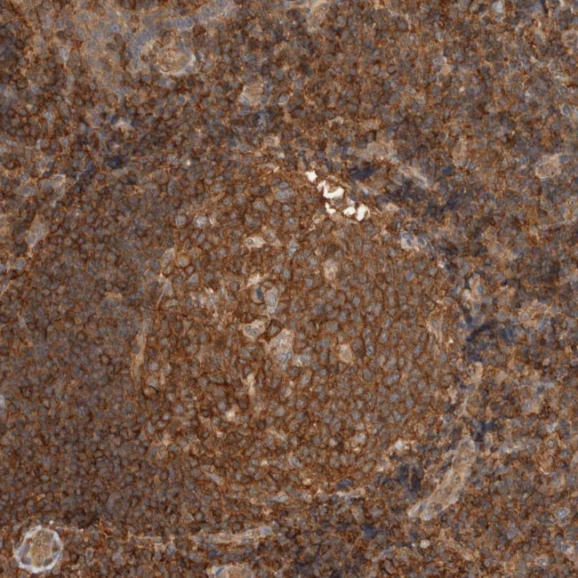 PFDN4 Antibody in Immunohistochemistry (Paraffin) (IHC (P))