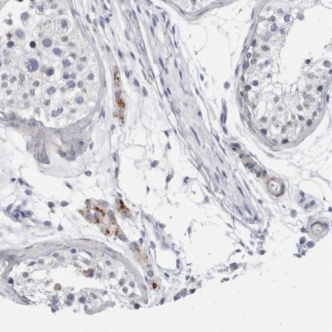 CATSPERD Antibody in Immunohistochemistry (Paraffin) (IHC (P))