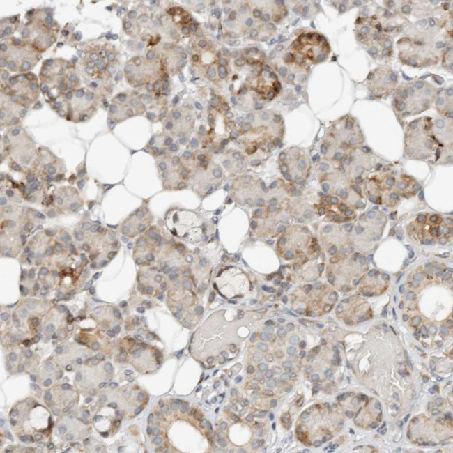 CCDC129 Antibody in Immunohistochemistry (Paraffin) (IHC (P))