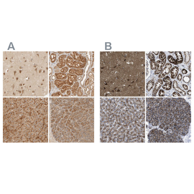 TMEM192 Antibody in Immunohistochemistry (IHC)
