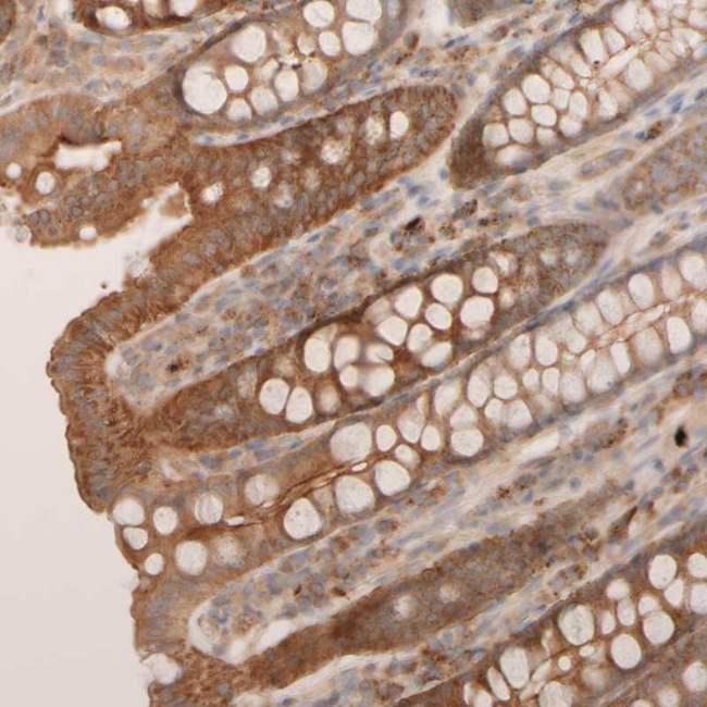 VSTM2A Antibody in Immunohistochemistry (Paraffin) (IHC (P))