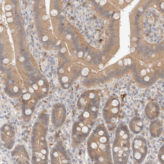 CHKA Antibody in Immunohistochemistry (Paraffin) (IHC (P))