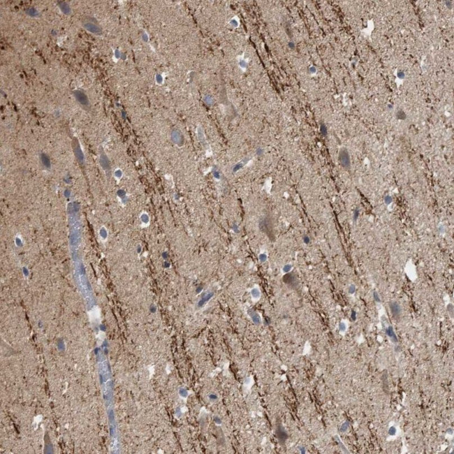 CAMSAP1 Antibody in Immunohistochemistry (IHC)