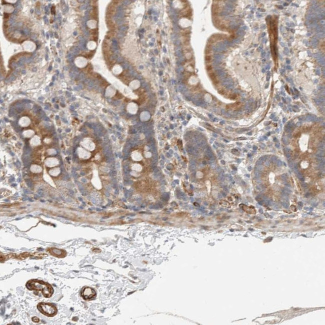 SIPA1L2 Antibody in Immunohistochemistry (Paraffin) (IHC (P))