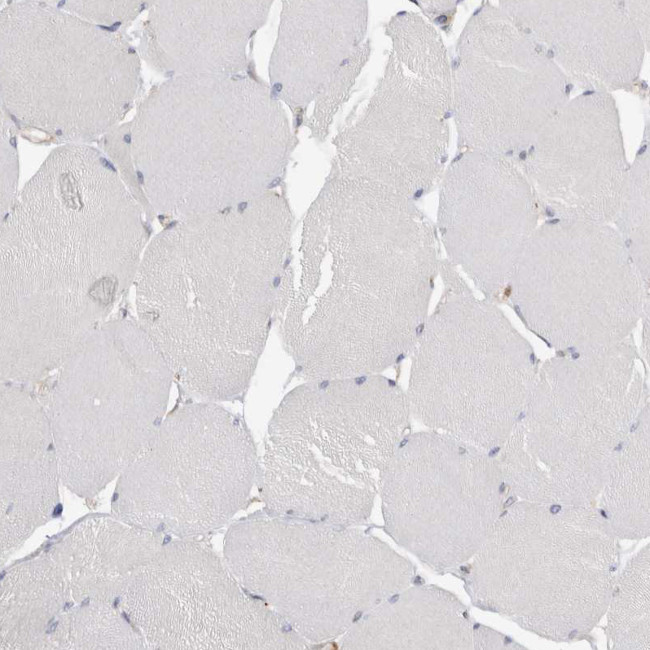NXT2 Antibody in Immunohistochemistry (Paraffin) (IHC (P))